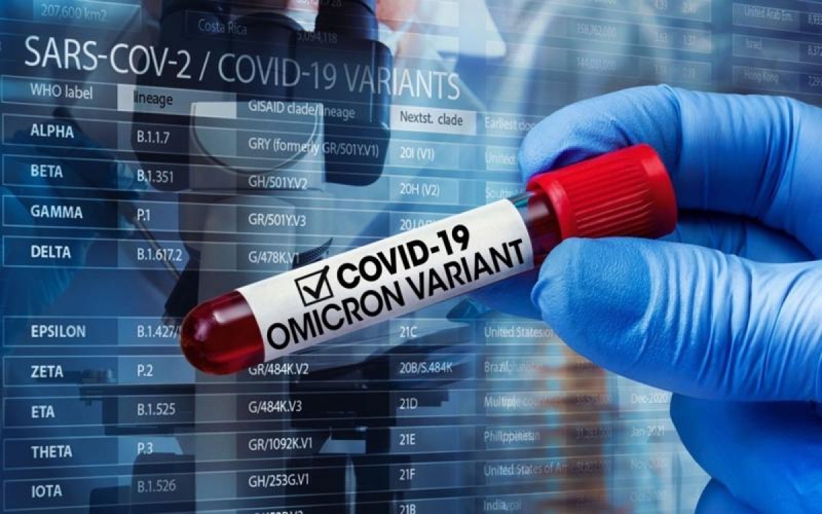 Bác sĩ chỉ rõ 2 thời điểm F0 cần test nhanh để có kết quả chính xác nhất, đỡ tốn kém 2 Bác sĩ chỉ rõ 2 thời điểm F0 cần test nhanh để có kết quả chính xác nhất, đỡ tốn kém 2