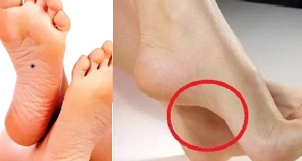 Nét tướng bàn chân dự đoán hậu vận: Người sống trong nhung lụa có 1 điểm 'cực độc' - Ảnh 1 Nét tướng bàn chân dự đoán hậu vận: Người sống trong nhung lụa có 1 điểm 'cực độc' - Ảnh 1