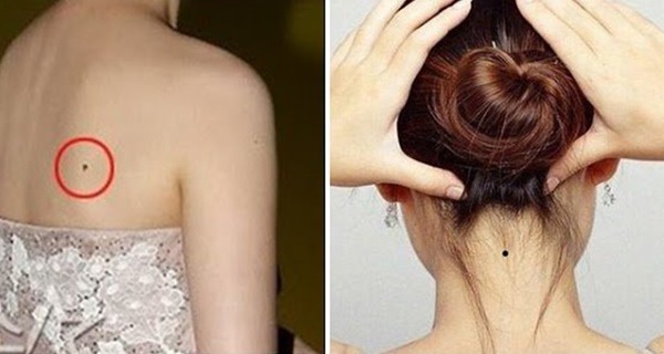 6 vị trí nốt ruồi vượng tướng: Phải tu 9 kiếp mới có, tẩy đi là mất ngay phúc phần - Ảnh 1 6 vị trí nốt ruồi vượng tướng: Phải tu 9 kiếp mới có, tẩy đi là mất ngay phúc phần - Ảnh 1