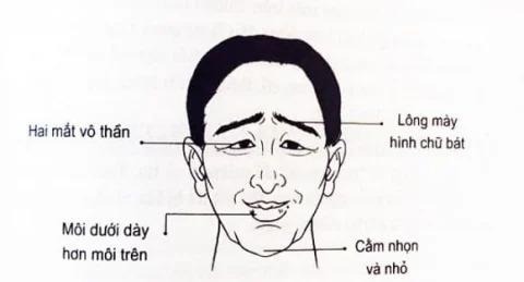 4 nét tướng của người yểu mệnh, dễ lao đao đủ thứ trong cuộc sống - Ảnh 2 4 nét tướng của người yểu mệnh, dễ lao đao đủ thứ trong cuộc sống - Ảnh 2