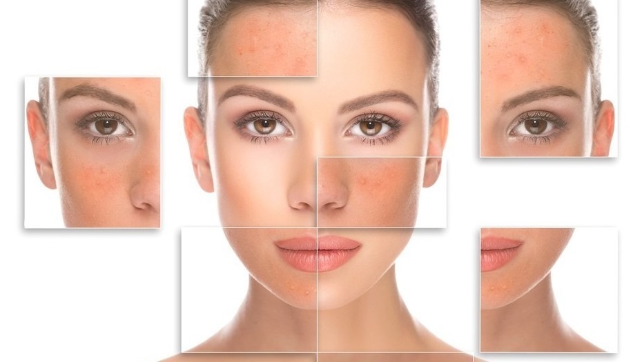 7 tai hại sẽ ập đến với nhan sắc của bạn nếu quên tẩy trang trước khi ngủ - Ảnh 3