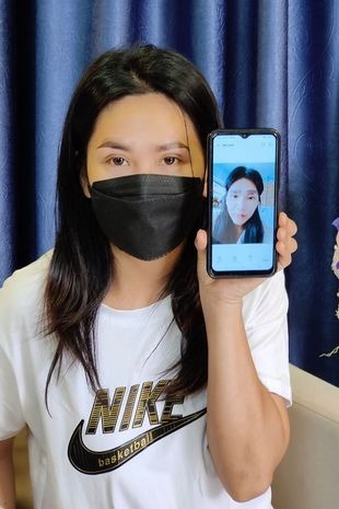 Cặp lông mày mới đã cứu vớt cô gái khỏi sự tự ti, mặc cảm.