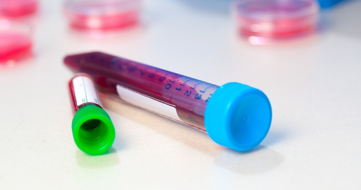 Phát hiện yếu tố trong máu gây tiểu đường, bệnh K sau 22 năm nghiên cứu