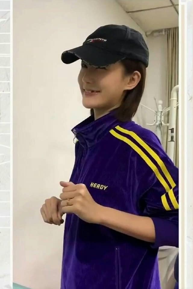 Chiếc răng gãy của Lý Nhất Đồng được 'chữa cháy' bằng keo 502