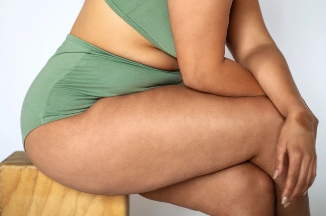 Phát hiện mới khiến đùi to, da sần vỏ cam trở thành khao khát của nhiều người