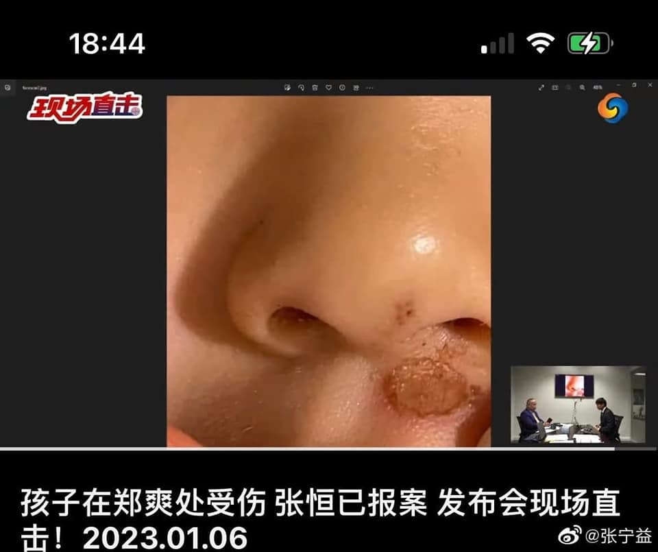 Hình ảnh mà Trương Hằng tung ra cho truyền thông.