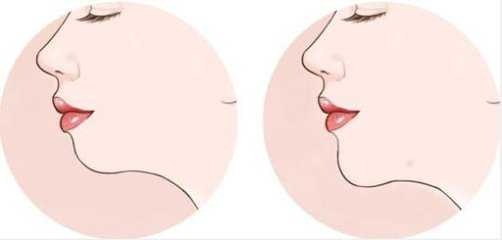 Phụ nữ mà có cằm ngắn thì hậu vận không tốt, ảnh hưởng đến chồng rất nhiều. Ảnh minh họa: Internet Phụ nữ mà có cằm ngắn thì hậu vận không tốt, ảnh hưởng đến chồng rất nhiều. Ảnh minh họa: Internet