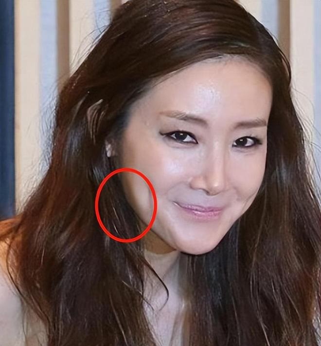 Gương mặt với nhiều chi tiết không còn như cũ của Choi Ji Woo.