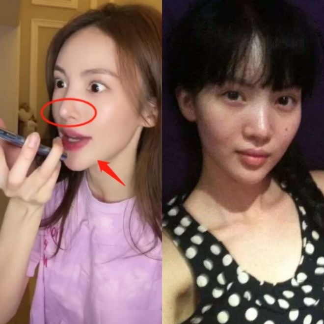 Lưu Thi Thi và những mỹ nhân Hoa ngữ lún sâu vào 'bão dao kéo', CDM tiếc nuối nhan sắc thuở ban đầu 13 Lưu Thi Thi và những mỹ nhân Hoa ngữ lún sâu vào 'bão dao kéo', CDM tiếc nuối nhan sắc thuở ban đầu 13