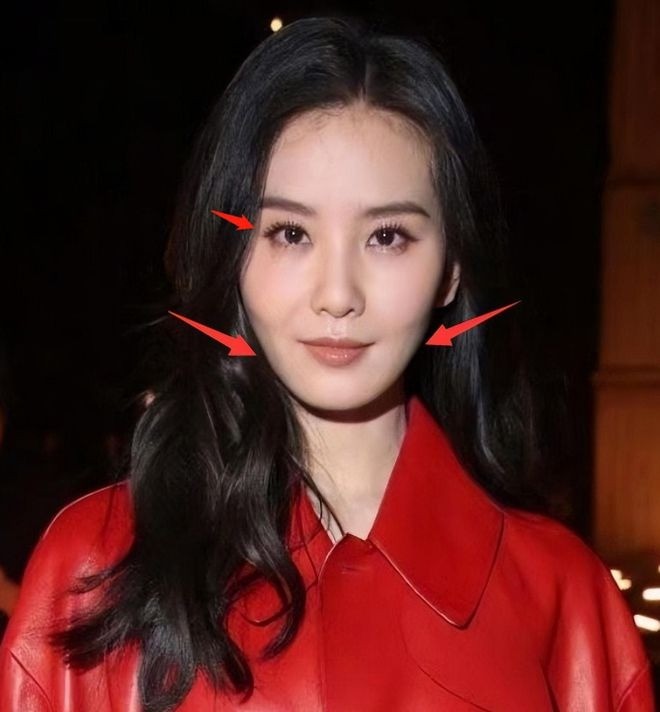 Lưu Thi Thi và những mỹ nhân Hoa ngữ lún sâu vào 'bão dao kéo', CDM tiếc nuối nhan sắc thuở ban đầu 4 Lưu Thi Thi và những mỹ nhân Hoa ngữ lún sâu vào 'bão dao kéo', CDM tiếc nuối nhan sắc thuở ban đầu 4