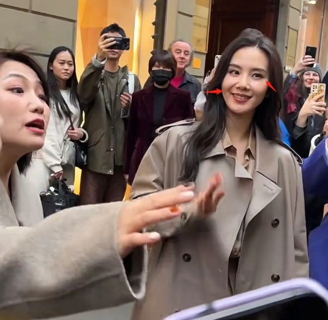 Lưu Thi Thi và những mỹ nhân Hoa ngữ lún sâu vào 'bão dao kéo', CDM tiếc nuối nhan sắc thuở ban đầu 5 Lưu Thi Thi và những mỹ nhân Hoa ngữ lún sâu vào 'bão dao kéo', CDM tiếc nuối nhan sắc thuở ban đầu 5