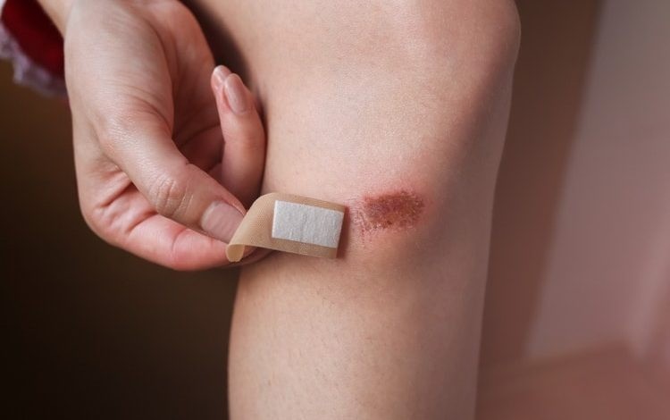 Vết thương chậm lành là dấu hiệu cho thấy hệ miễn dịch bị tổn thương. Ảnh minh họa: Internet