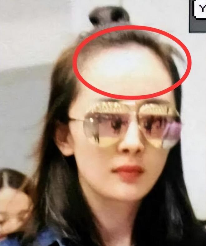 Vầng trán sân bay luôn là điểm yếu của cô nàng. Vầng trán sân bay luôn là điểm yếu của cô nàng.