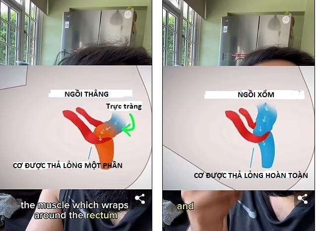 Khi ngồi xổm, bụng và đùi tạo thành một góc nhọn thì các cơ quanh trực tràng được thả lỏng hoàn toàn. Ảnh minh họa: Dailymail Khi ngồi xổm, bụng và đùi tạo thành một góc nhọn thì các cơ quanh trực tràng được thả lỏng hoàn toàn. Ảnh minh họa: Dailymail