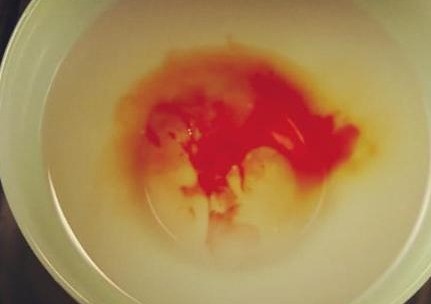 Chích máu nghiệm thân là phương pháp xác nhận huyết thống sai lầm của người xưa. Ảnh minh họa: Internet