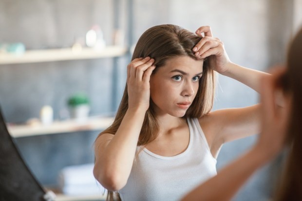 Tóc rụng nhiều vào mùa đông là hiện tượng bình thường. Bạn có thể thực hiện một số thay đổi để cải thiện tình trạng này. Ảnh minh họa: Internet Tóc rụng nhiều vào mùa đông là hiện tượng bình thường. Bạn có thể thực hiện một số thay đổi để cải thiện tình trạng này. Ảnh minh họa: Internet