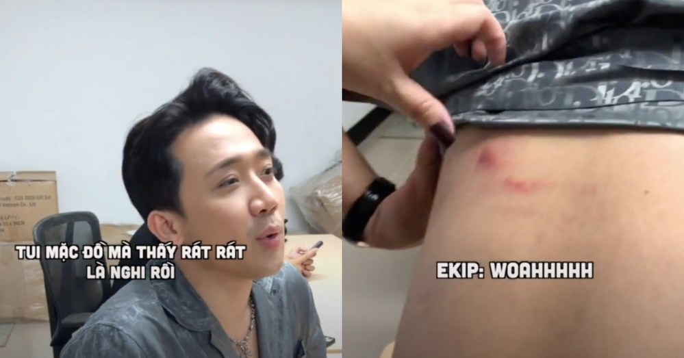 Trấn Thành bị cào cấu đến chảy máu.