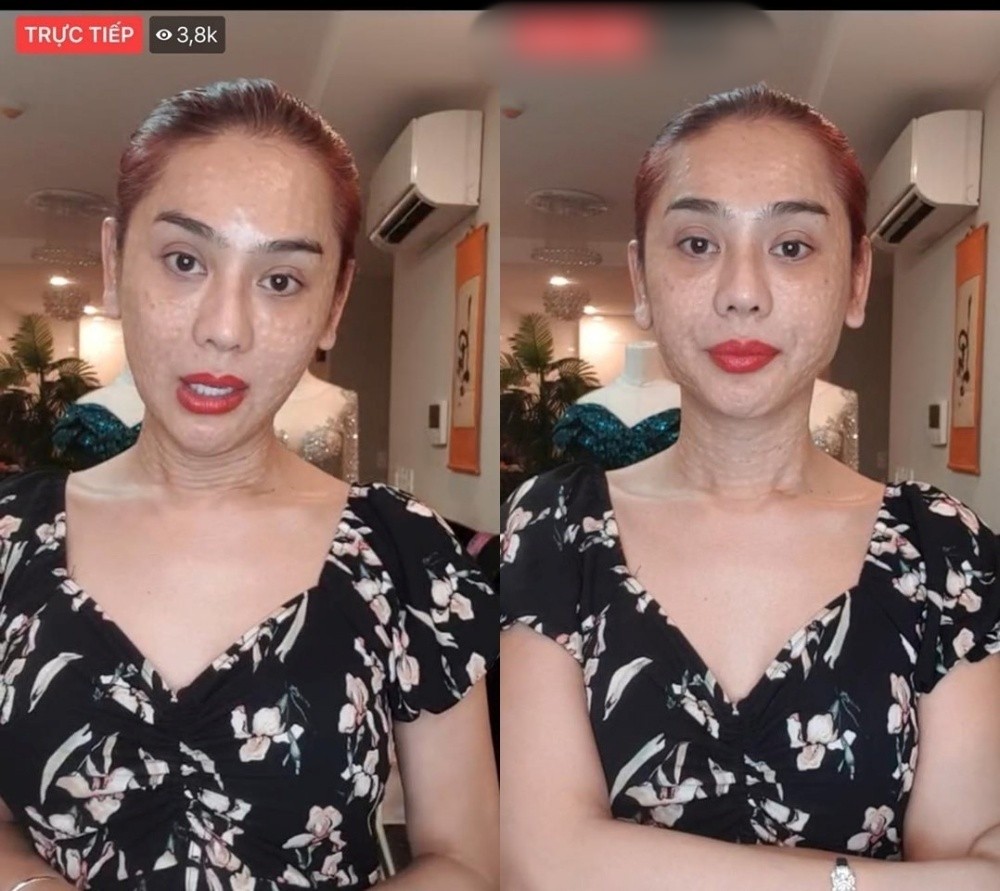 Lâm Khánh Chi từng không ít lần gây tranh cãi với diện mạo xuống cấp, khác xa với hình ảnh chỉnh sửa được chia sẻ trên MXH. Ảnh chụp màn hình