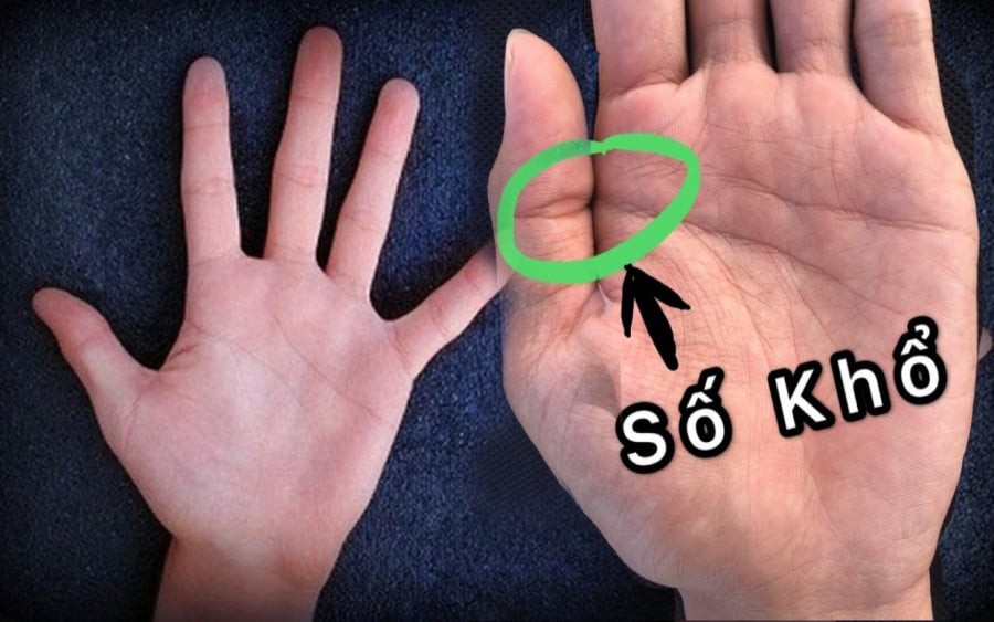 Cổ nhân nói chẳng sai, chỉ cần 1 trong 4 đặc điểm này ở lòng bàn tay cũng đã khổ đủ đường - Ảnh 2