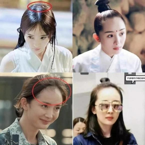 Dương Mịch thường xuyên bị soi chi tiết bị hói đường chân tóc sau khi sinh con đầu lòng. Ảnh: Internet