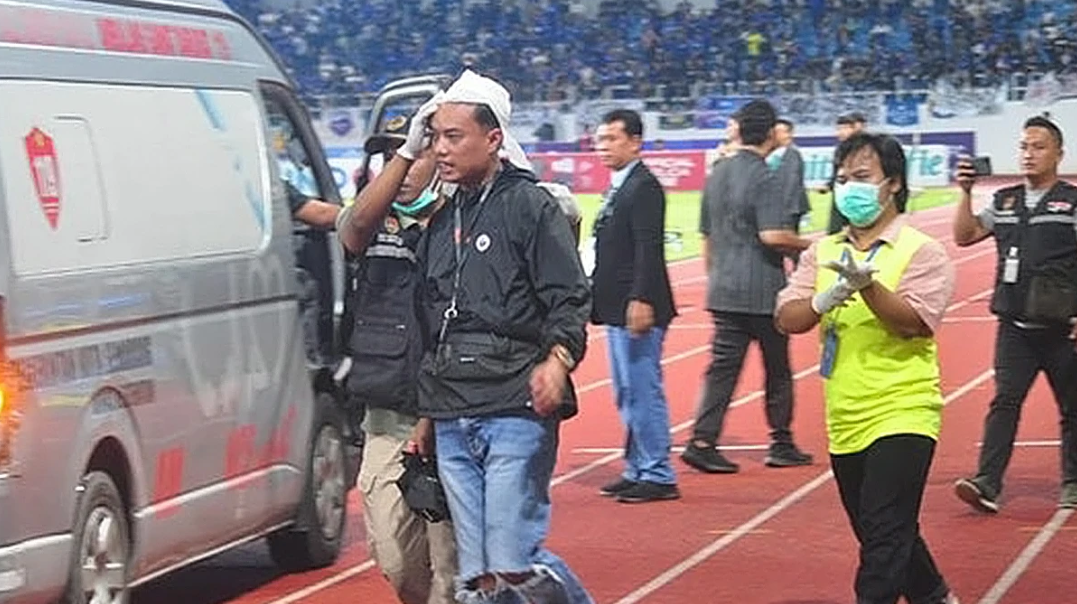 Một CĐV bị thương trong cuộc bạo loạn. Ảnh: Internet