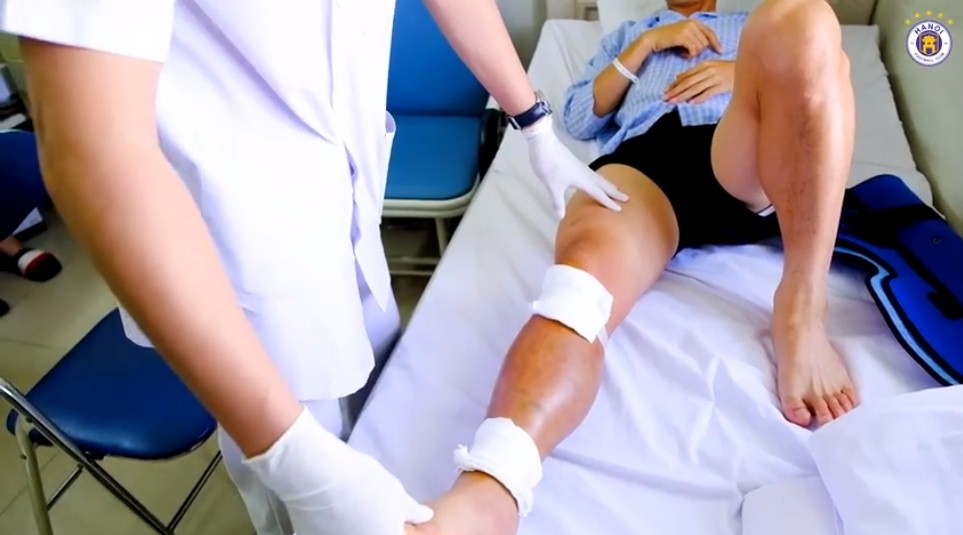 Phần chân của Đỗ Hùng Dũng sau khi phẫu thuật vẫn còn sưng rất to. Ảnh: HNFC Phần chân của Đỗ Hùng Dũng sau khi phẫu thuật vẫn còn sưng rất to. Ảnh: HNFC
