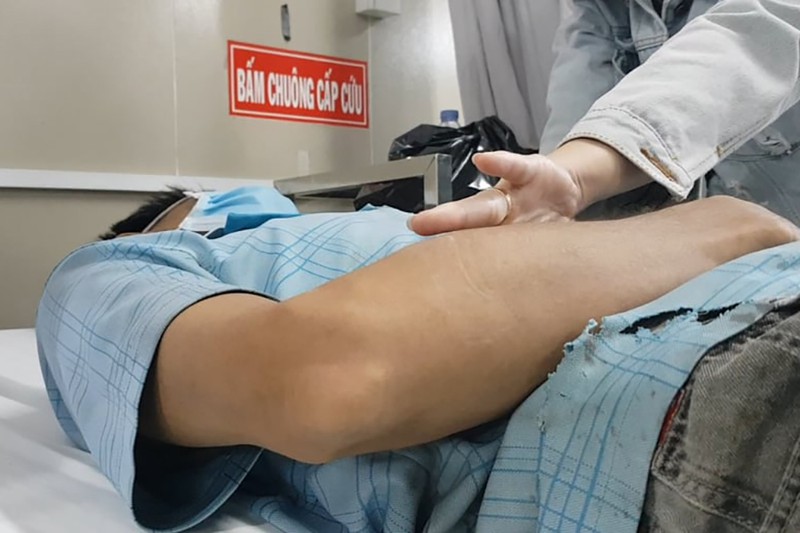 Sau khi được các bác sĩ điều trị, anh Tựu đã được xuất viện. Ảnh: PLO Sau khi được các bác sĩ điều trị, anh Tựu đã được xuất viện. Ảnh: PLO