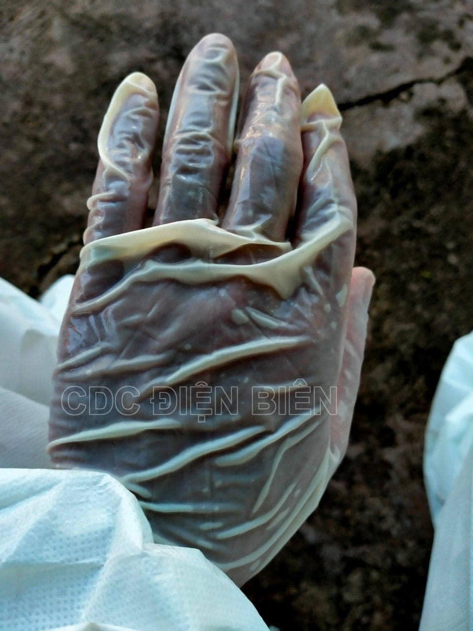 Ảnh: CDC Điện Biên