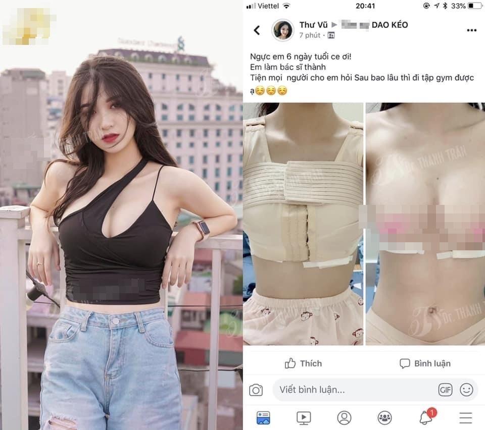Cô nàng còn công khai khoe thành quả trên một group có tiếng về PTTM. Ảnh: MXH Cô nàng còn công khai khoe thành quả trên một group có tiếng về PTTM. Ảnh: MXH