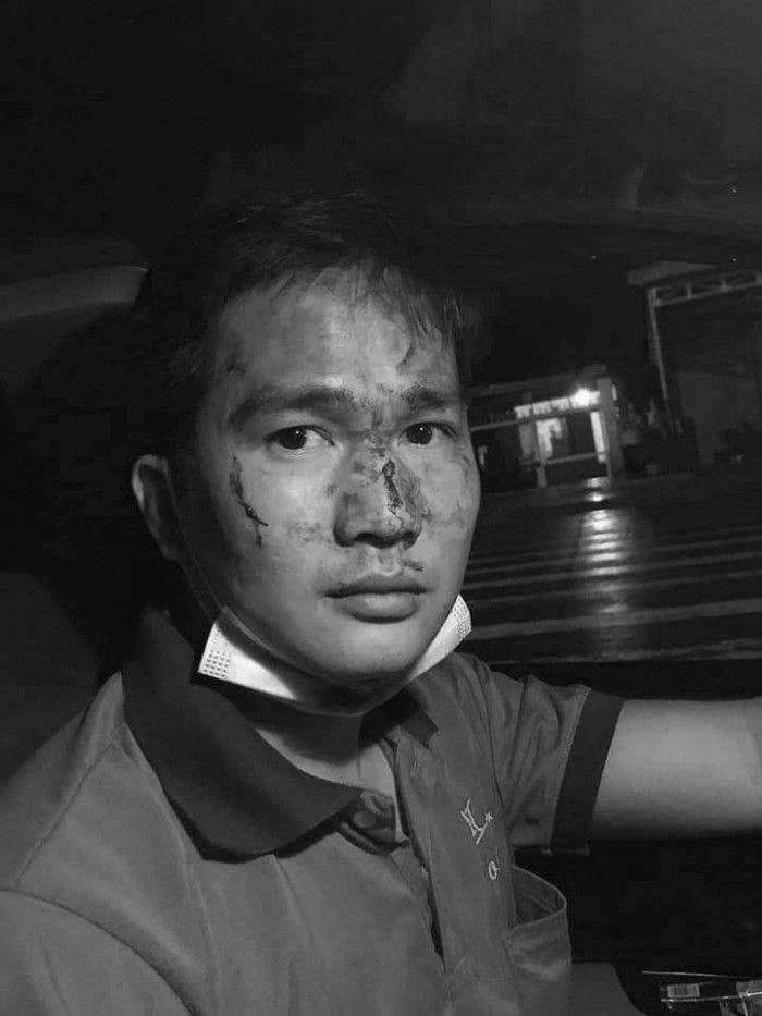 Vụ tài xế taxi bị hành hung ở Bình Phước: Đã xác định danh tính hành khách côn đồ 5