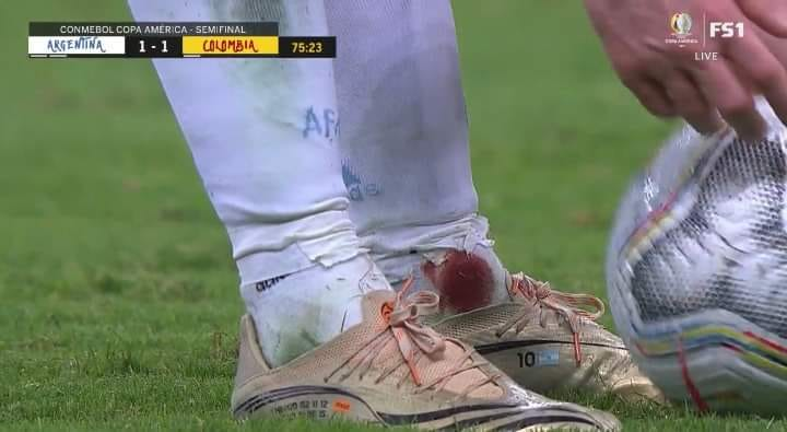 Chân Messi chảy máu, chấn thương vẫn cố gắng gồng gánh Argentina vào chung kết Copa America 3