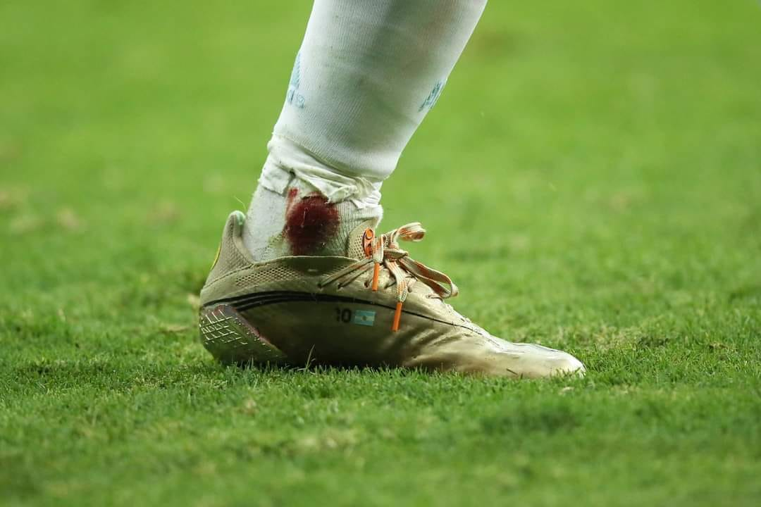 Chân Messi chảy máu, chấn thương vẫn cố gắng gồng gánh Argentina vào chung kết Copa America 4