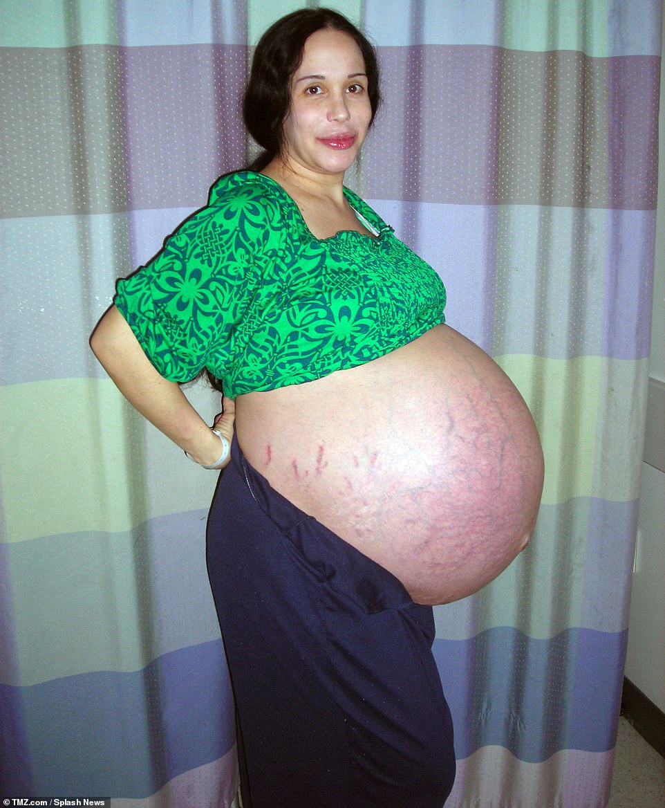 Suleman trở nên nổi tiếng khi mang thai 8 đứa trẻ sau khi cấy 12 phôi thai cùng lúc. Ảnh: Splash News