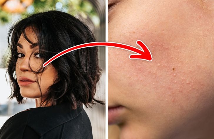 Những thói quen khiến 7749 bước skincare của bạn đều 'đổ sông đổ biển' - Ảnh 6 Những thói quen khiến 7749 bước skincare của bạn đều 'đổ sông đổ biển' - Ảnh 6