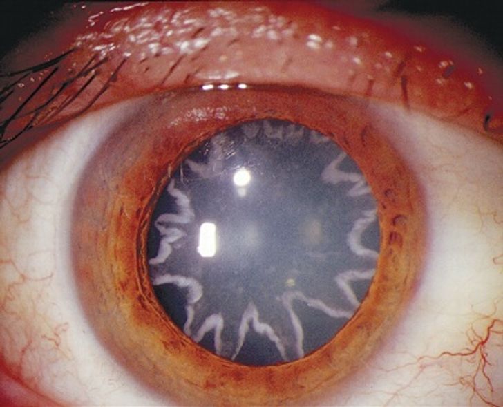 Một thợ điện đã bị bỏ lại những ngôi sao trong mắt sau khi trải qua một cú sốc điện 14.000 vôn xuyên qua cơ thể.