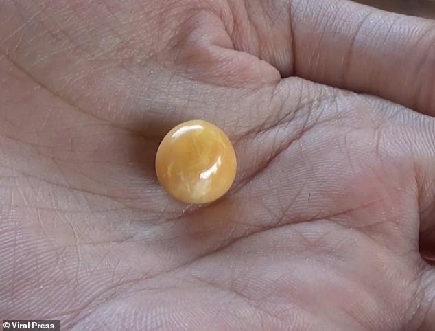 Kodchakorn Tantiwiwatkul tìm thấy một viên ngọc trai Melo hiếm trong vỏ ốc. Ảnh: ViralPress Kodchakorn Tantiwiwatkul tìm thấy một viên ngọc trai Melo hiếm trong vỏ ốc. Ảnh: ViralPress