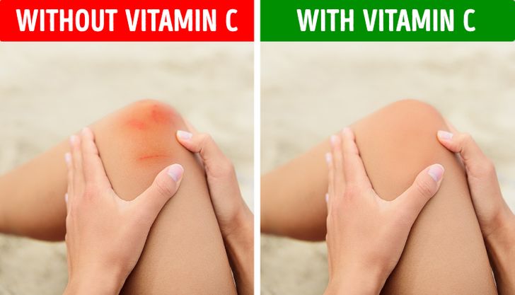 Cả ngày uể oải và 9 dấu hiệu cảnh báo cơ thể đang thiếu một vi chất cực kỳ quan trọng - Ảnh 1 Cả ngày uể oải và 9 dấu hiệu cảnh báo cơ thể đang thiếu một vi chất cực kỳ quan trọng - Ảnh 1