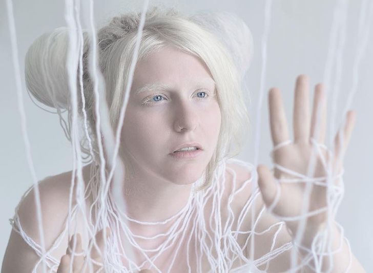 Màu mắt của người bị bạch tạng có thể có màu nâu sẫm, nâu nhạt, xanh lá cây hay xanh da trời.