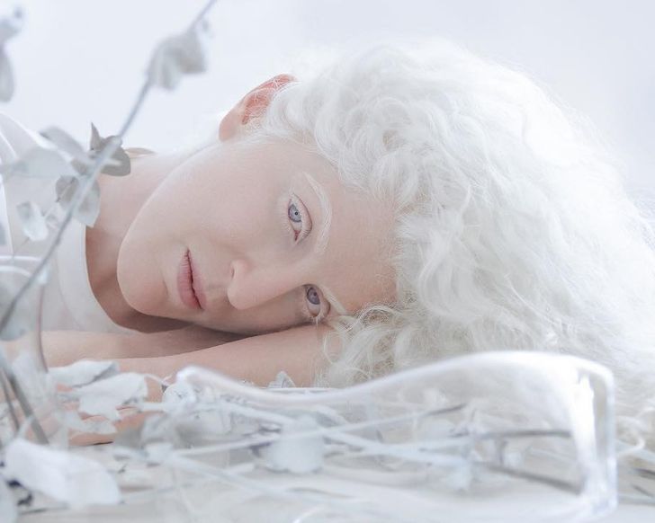 Đắm chìm trước vẻ đẹp lạ của những người bạch tạng - Ảnh 1