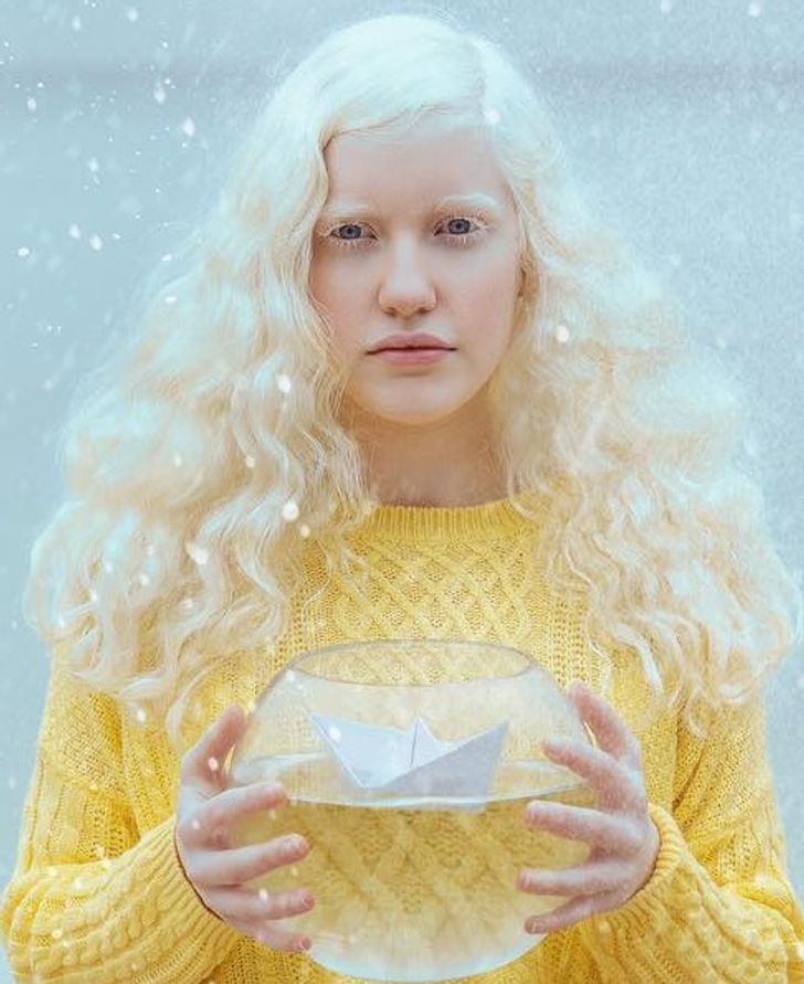 Da của người bị bạch tạng dễ bị bỏng nắng, do đó dễ bị ung thư da.