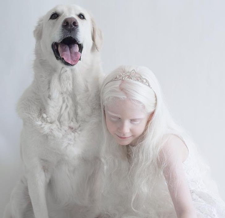 Đắm chìm trước vẻ đẹp lạ của những người bạch tạng - Ảnh 8