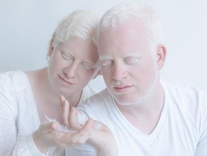 Đắm chìm trước vẻ đẹp lạ của những người bạch tạng - Ảnh 5