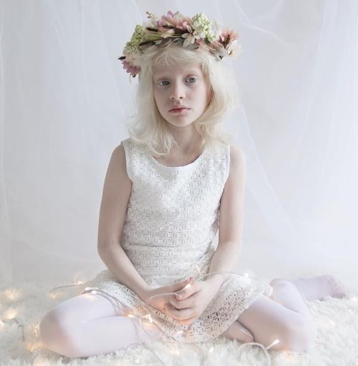 Đắm chìm trước vẻ đẹp lạ của những người bạch tạng - Ảnh 4