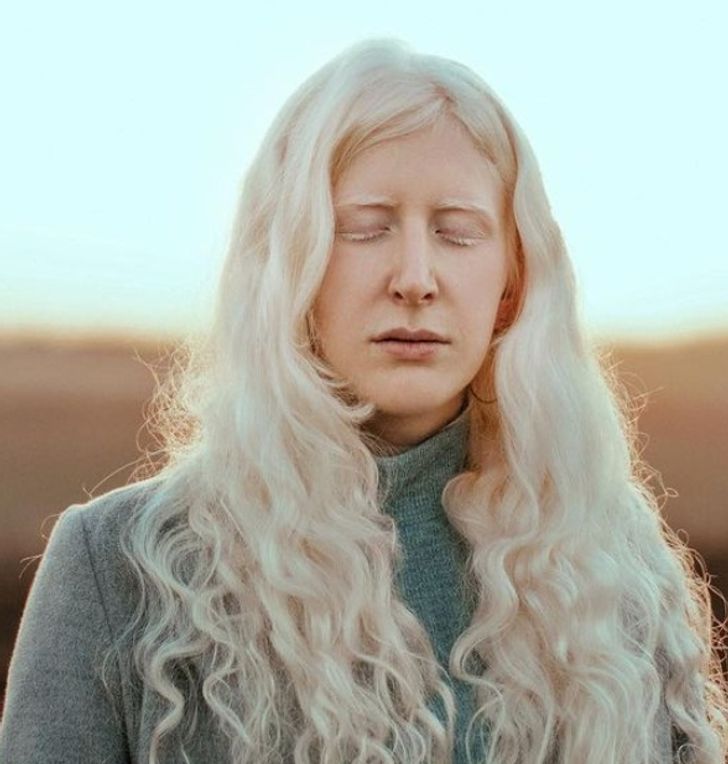 Đắm chìm trước vẻ đẹp lạ của những người bạch tạng - Ảnh 3