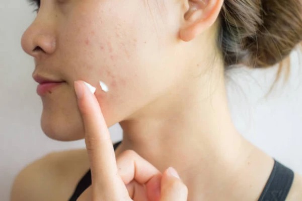 Quá nhiều bước skincare có thể quá tải với làn da nhạy cảm. Quá nhiều bước skincare có thể quá tải với làn da nhạy cảm.
