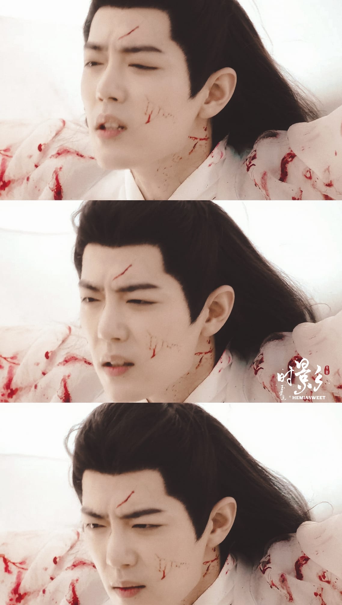 Tạo hình thương tích như thế này thì ngay cả người qua đường cũng cảm thấy xót.