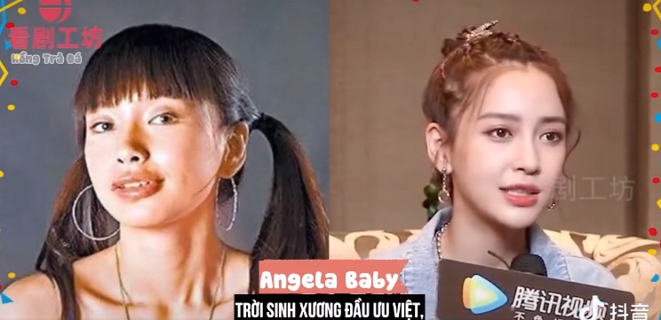 Angela Baby cũng là một minh chứng của việc chỉnh sửa nhan sắc thành công. Giờ đây, cô ấy được xem như một trong những tượng đài nhan sắc của Cbiz. Cô nàng phủ nhận chuyện dao kéo, chỉ khẳng định mình làm răng dẫn đến những thay đổi về nhan sắc như hiện tại. Nếu đó là sự thật thì niềng răng là quyết định sáng suốt nhất cuộc đời của Angela Baby.