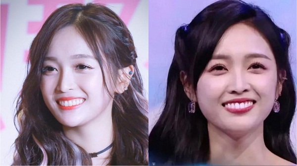 Thế nhưng khi làm răng sứ, Ngô Tuyên Nghi lại bị hô, nụ cười trở nên kém thẩm mỹ hơn trước.