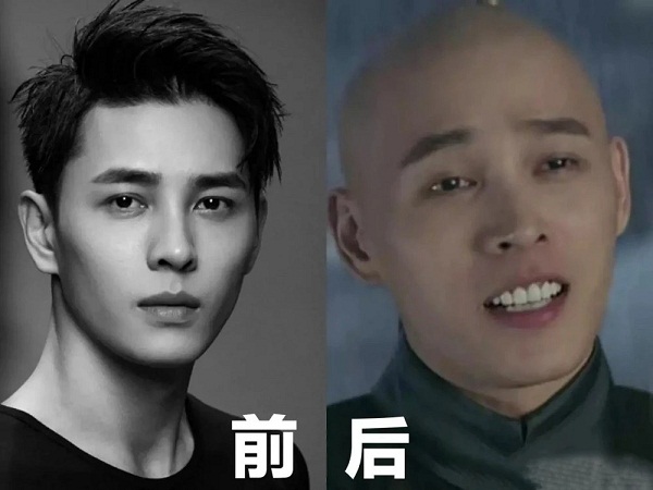 Răng của Hồng Nghiêu ban đầu vốn rất đẹp rồi nhưng anh muốn hoàn hảo hơn nữa và chọn làm răng sứ. Thật không ngờ sau khi làm răng xong thì từ một mỹ nam lạnh lùng, Hồng Nghiêu trở thành một anh chàng hô nhẹ.