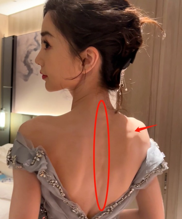 Netizen xót xa khi Angela Baby gầy tới mức nổi rõ đường sống lưng như thế này. Netizen xót xa khi Angela Baby gầy tới mức nổi rõ đường sống lưng như thế này.
